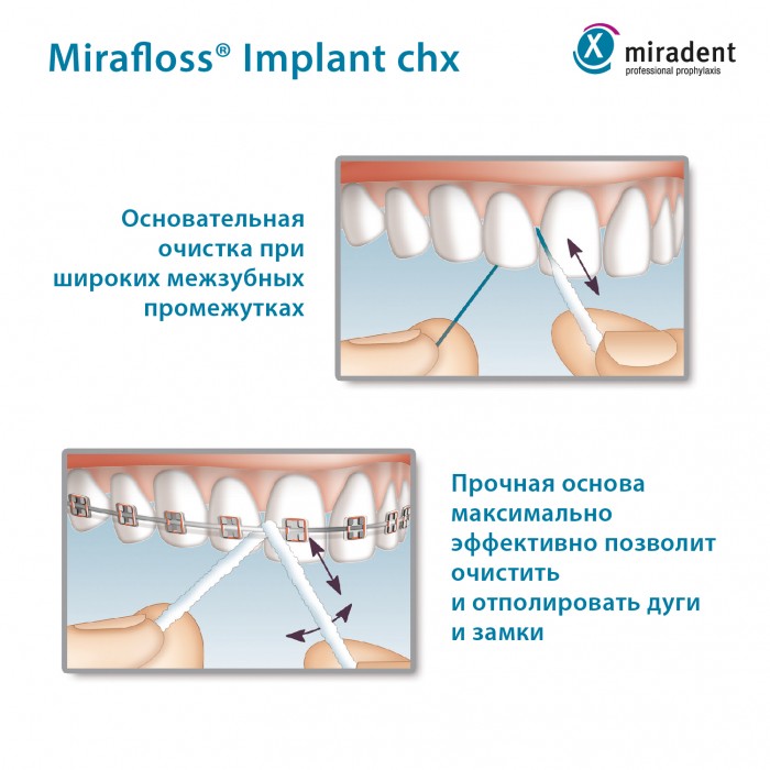 Miradent Implant CHX Fine зубная нить для имплантов и брекетов 1,8 мм (50 шт по 15 см)