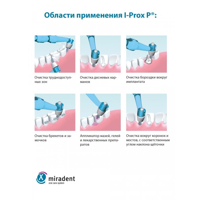 Miradent I-Prox P сменные насадки для монопучковой щетки (4 шт)